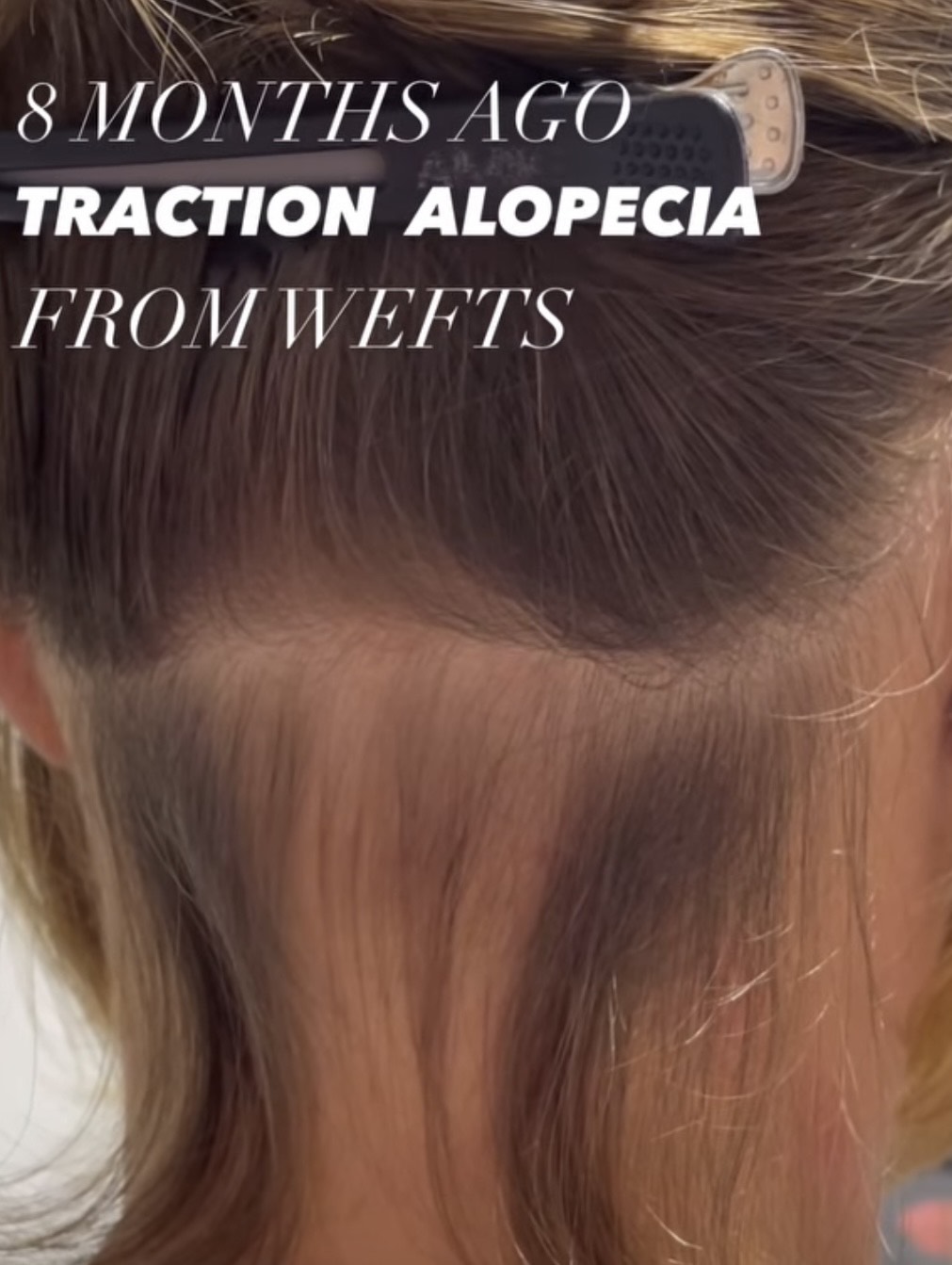 The Origins of Modern-Day Anxiety with Hair&nbsp;Extensions