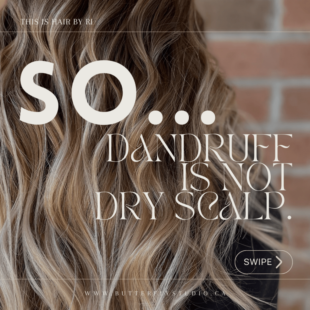 Dandruff and Dry Scalp Are Not The Same&nbsp;Thing